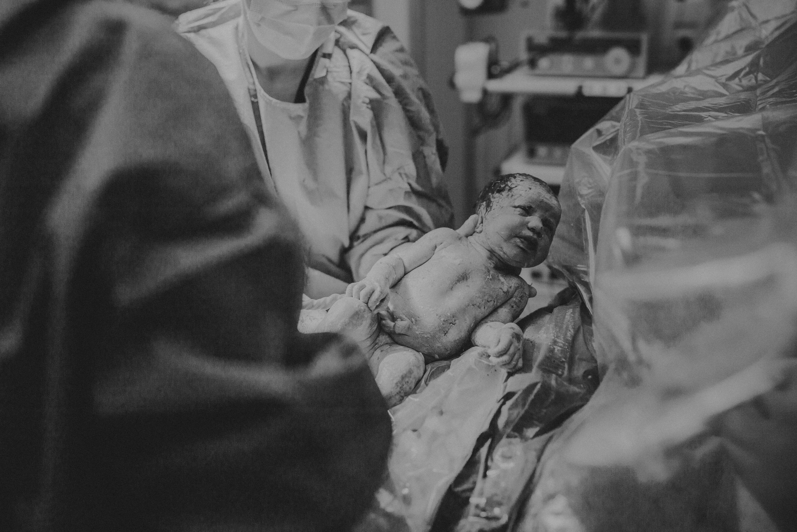 keizersnede fotografie geboortefotografie